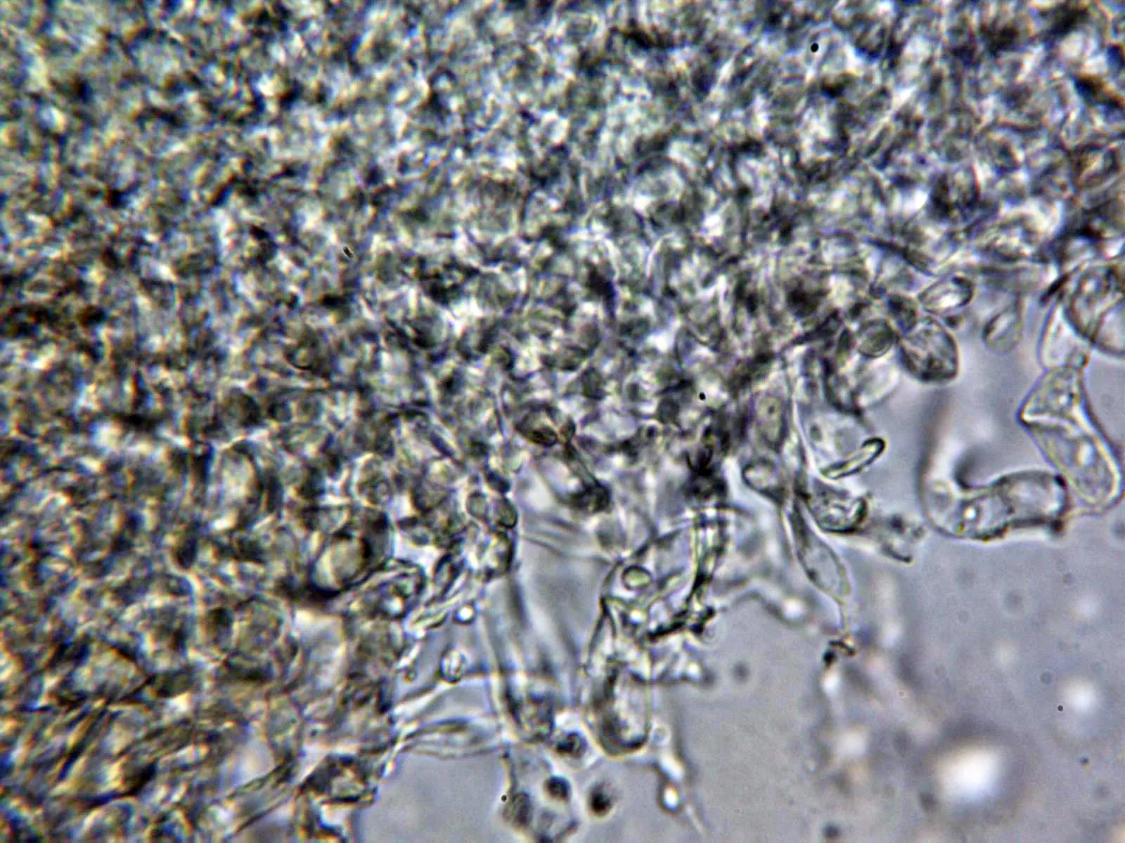 Microscopía de Lycoperdon perlatum - 10 - Exoperidio